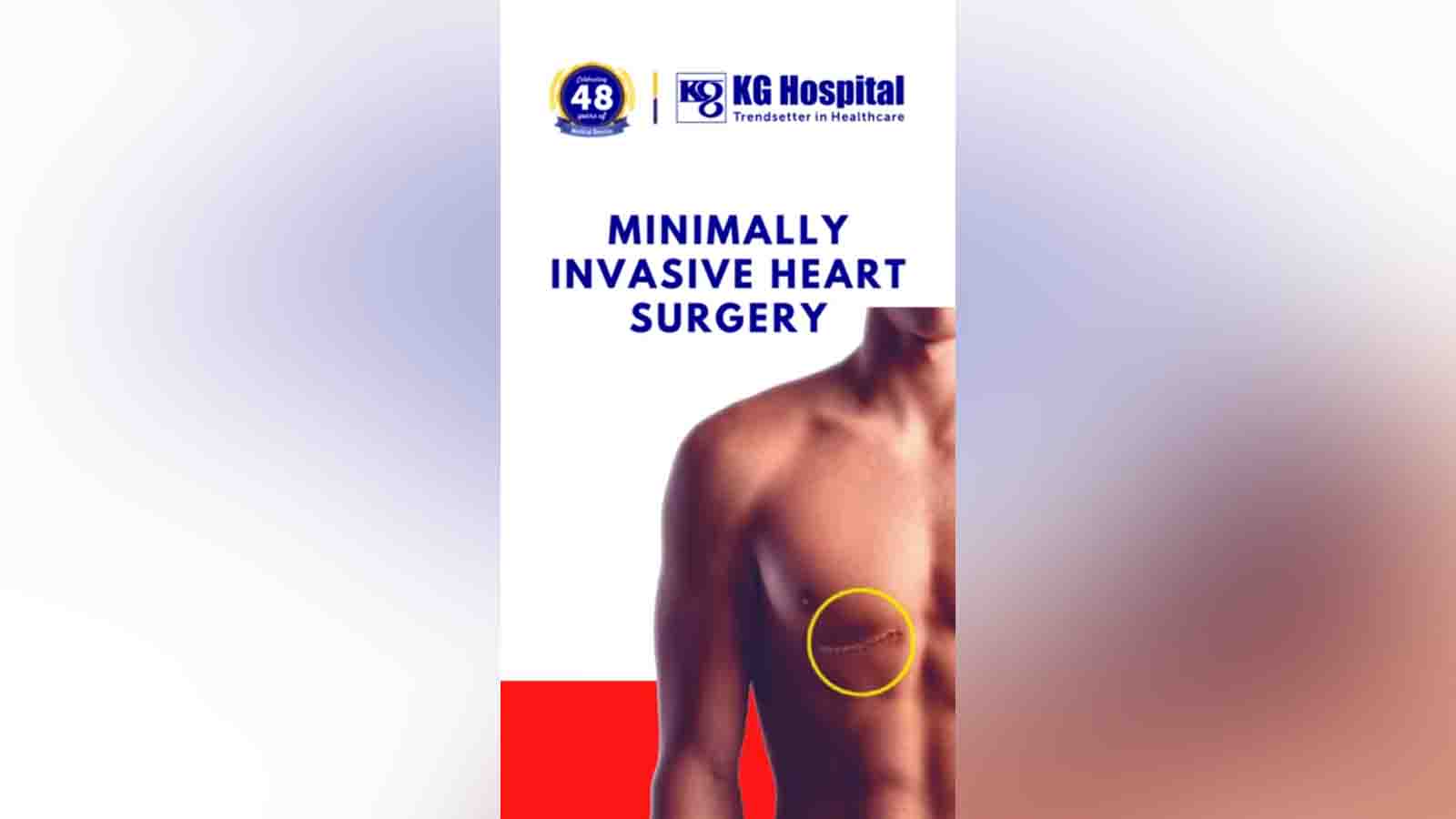 minimally invasive cardiac surgery in Coimbatore.jpg